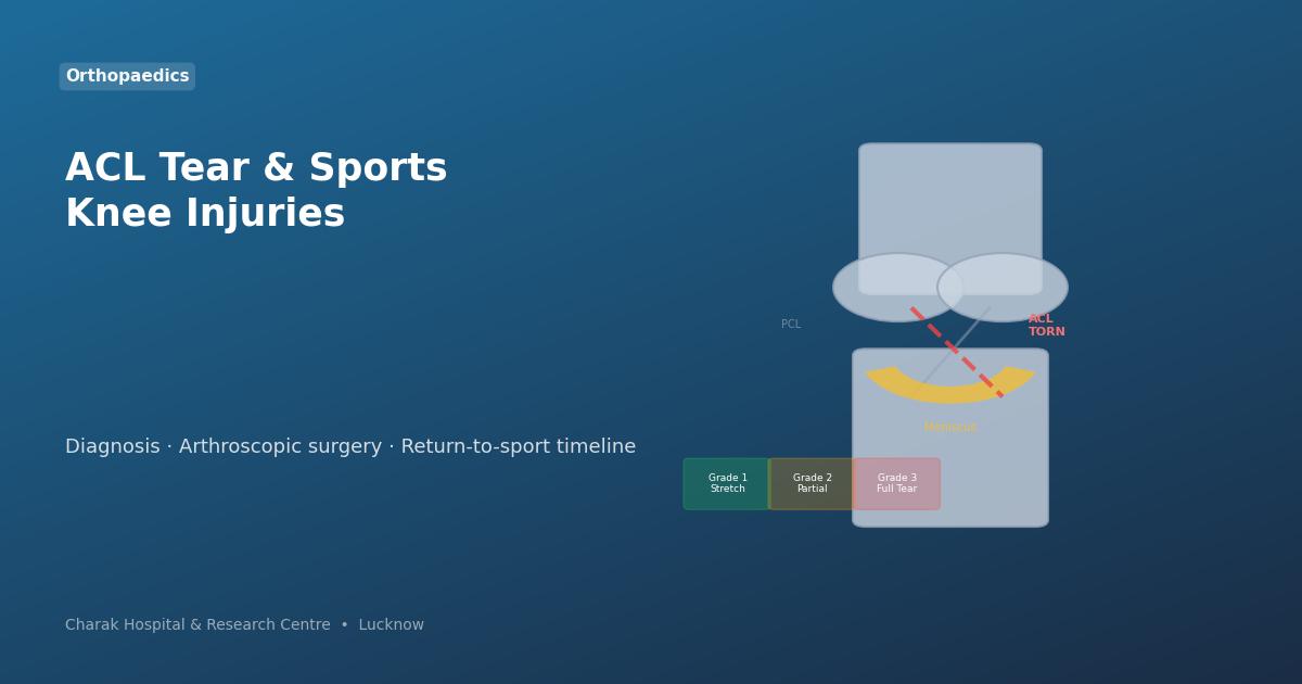 ACL tear and sports knee injury anatomy diagram — Charak Hospital Lucknow