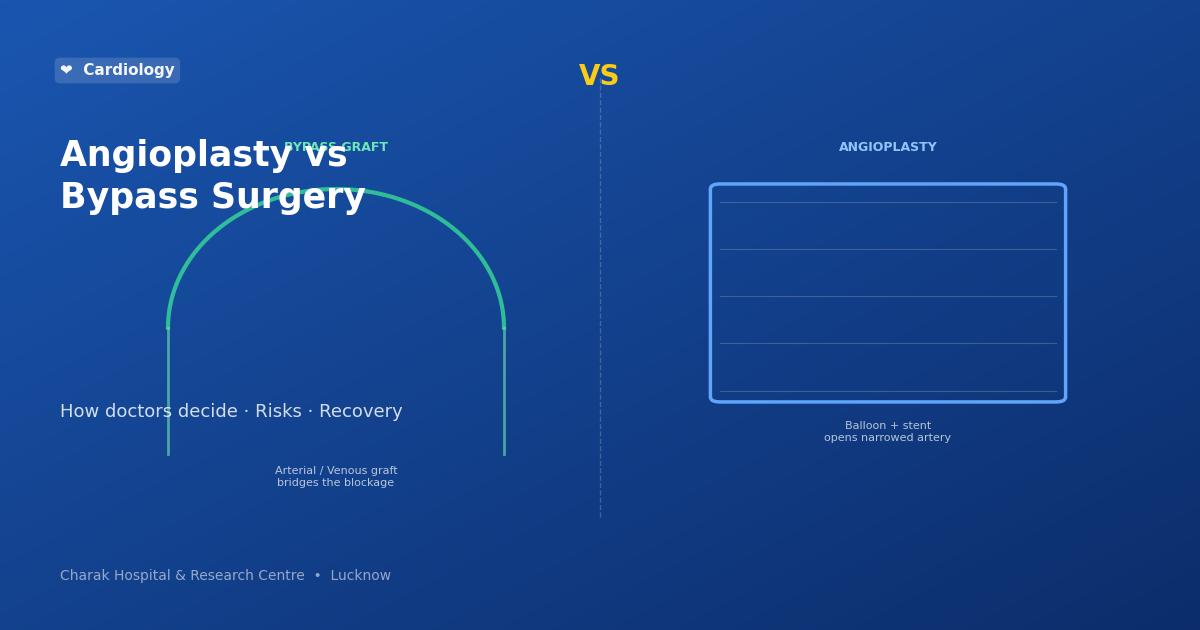 Angioplasty vs bypass surgery comparison — Charak Hospital Lucknow