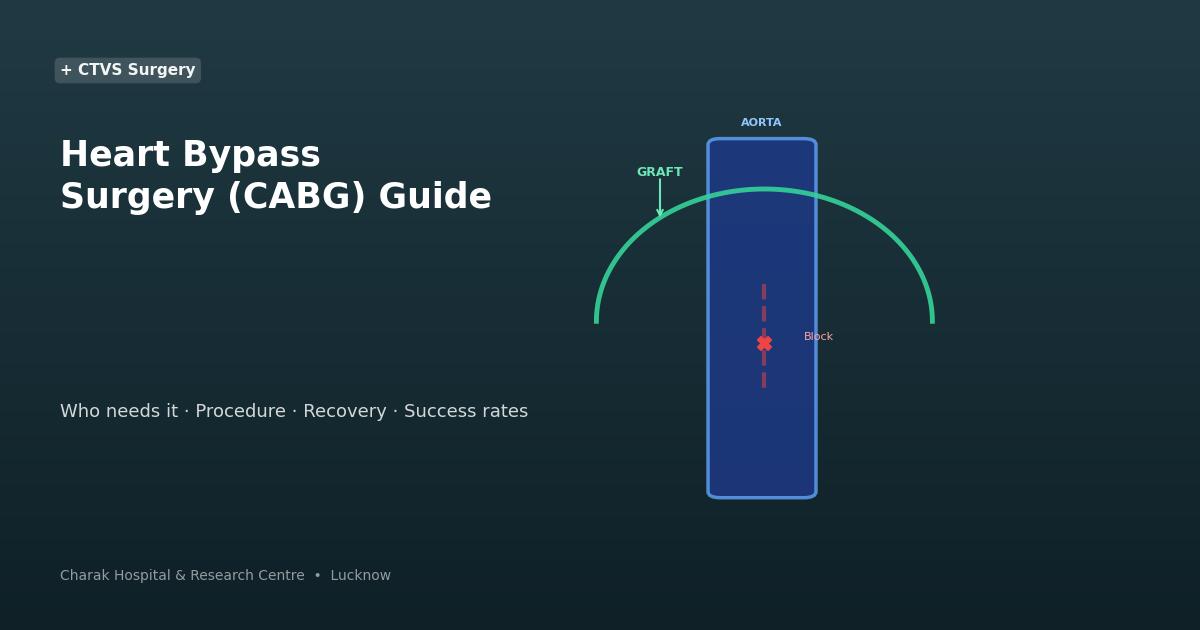 Heart bypass surgery CABG graft diagram — Charak Hospital Lucknow
