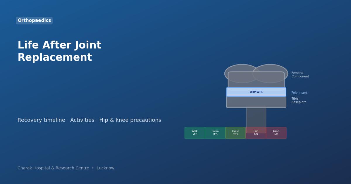 Knee joint replacement implant components diagram — Charak Hospital Lucknow